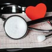 Visita cardiologica, quando farla? Ecco i sintomi